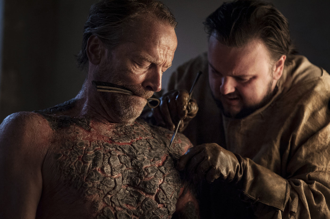 Here's How They Made That Disgusting Greyscale Surgery Scene on Game of  Thrones - The Credits